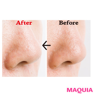 大人の毛穴も徹底解消！ メラニン＆開きエイジング毛穴を2週間ケアした結果は？_2_7