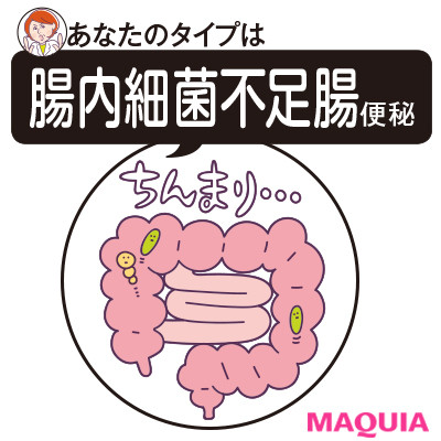 腸内細菌不足腸便秘