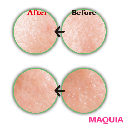 大人の毛穴も徹底解消！ メラニン＆開きエイジング毛穴を2週間ケアした結果は？_2_8