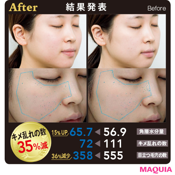 酷いむくみを何とかしたい イプサの セラム 0 で頰のもたつきがすっきり Happy Plus One ハピプラワン