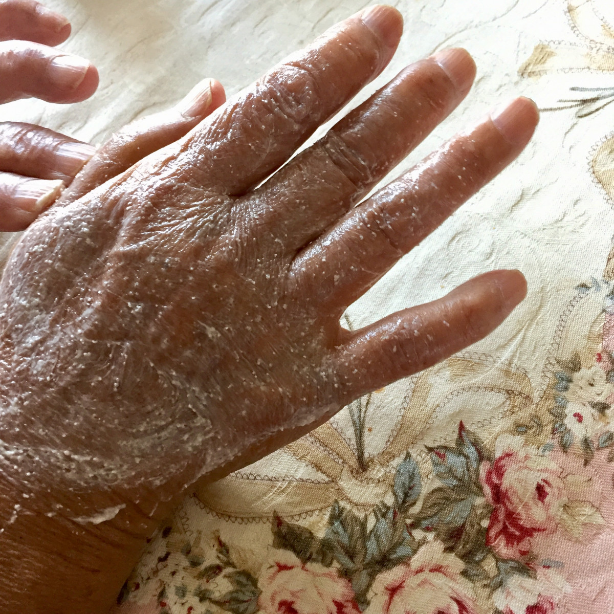 Image title Image title