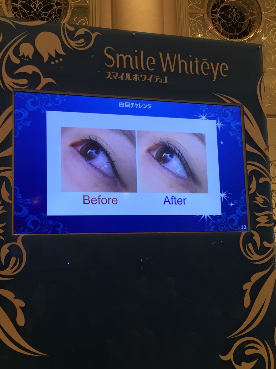 Image title Image title